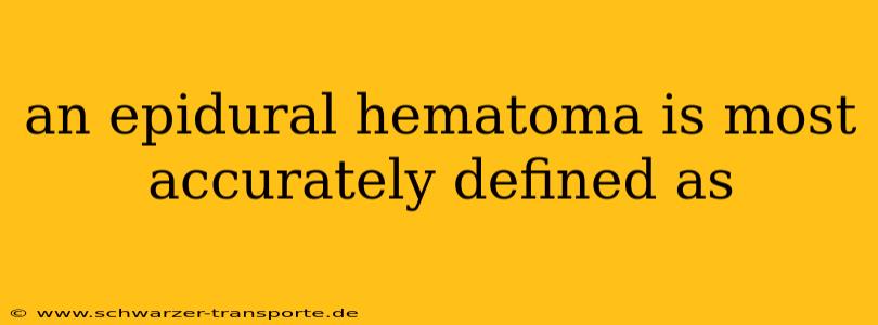 an epidural hematoma is most accurately defined as