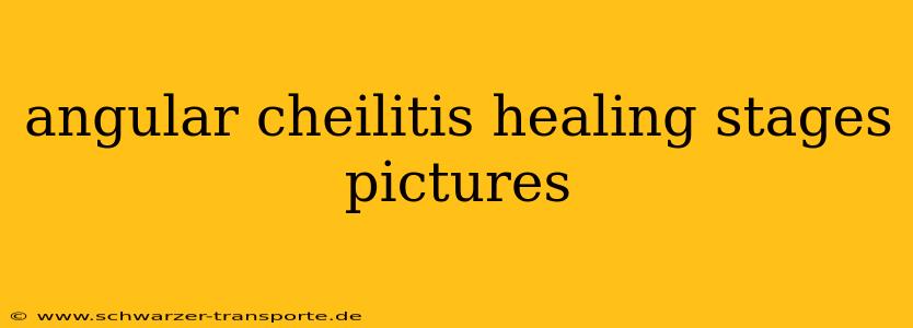 angular cheilitis healing stages pictures