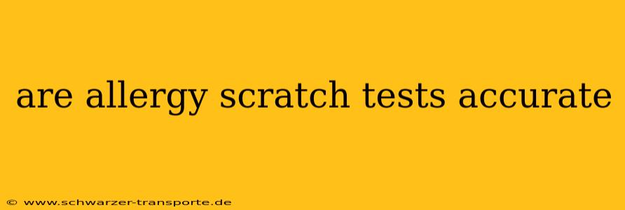 are allergy scratch tests accurate