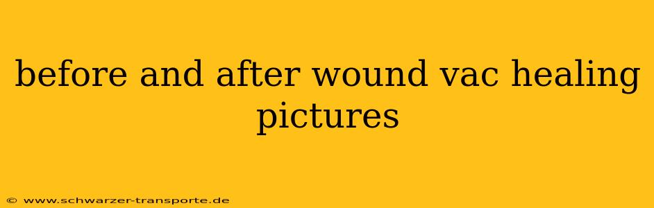 before and after wound vac healing pictures