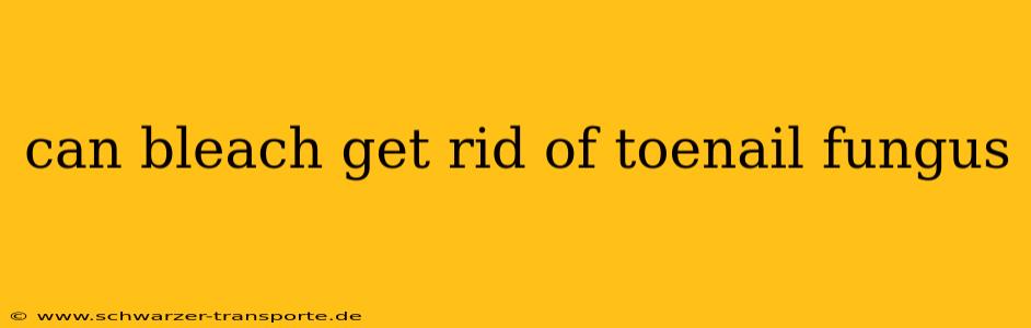 can bleach get rid of toenail fungus