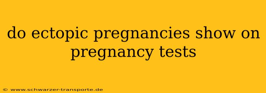 do ectopic pregnancies show on pregnancy tests