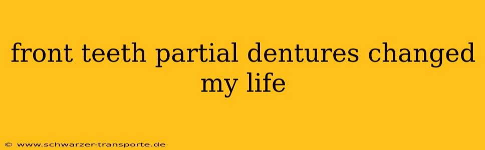 front teeth partial dentures changed my life