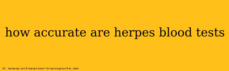 how accurate are herpes blood tests