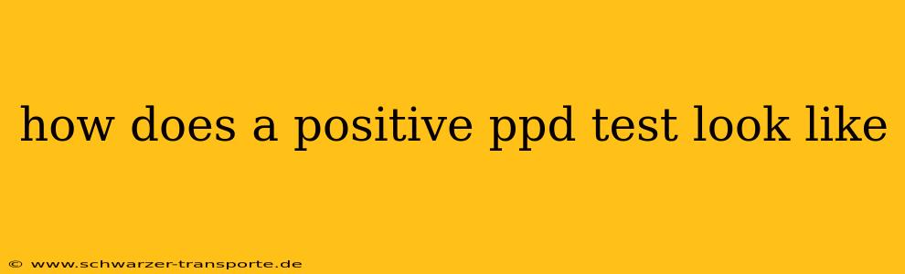 how does a positive ppd test look like