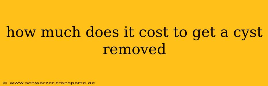 how much does it cost to get a cyst removed