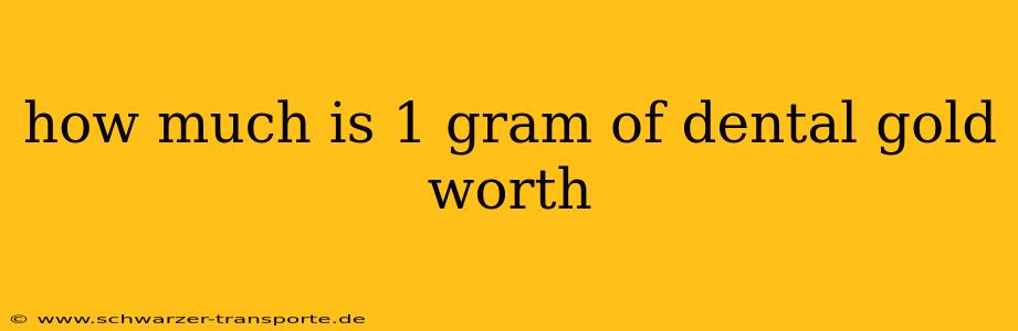 how much is 1 gram of dental gold worth