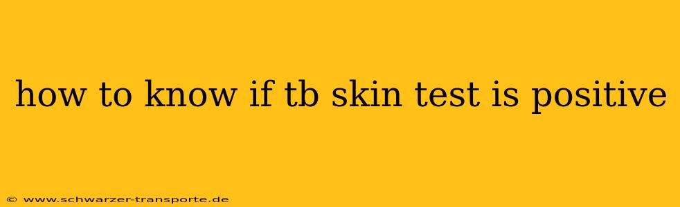 how to know if tb skin test is positive