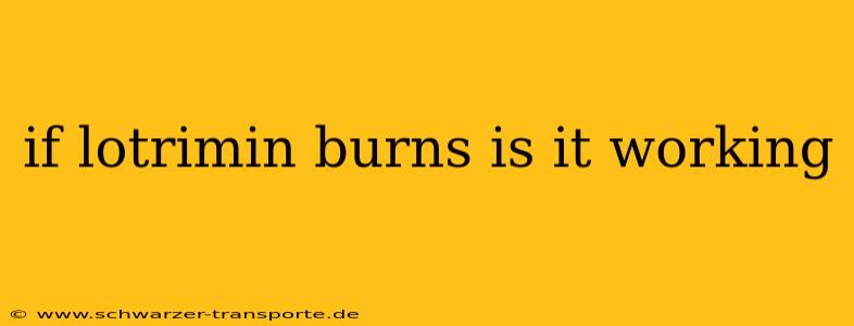 if lotrimin burns is it working