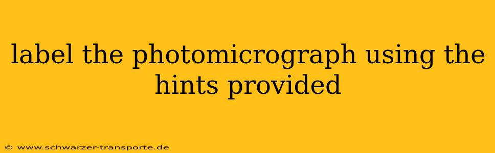 label the photomicrograph using the hints provided