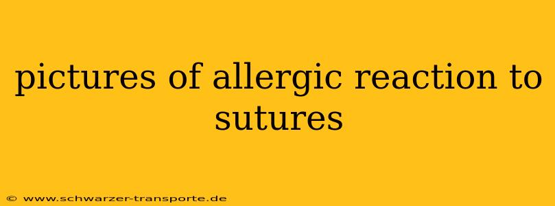 pictures of allergic reaction to sutures
