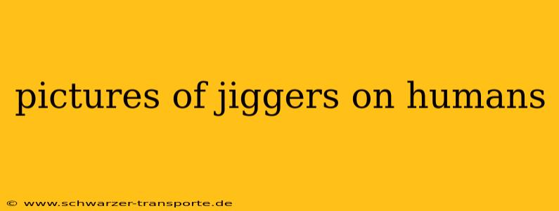 pictures of jiggers on humans