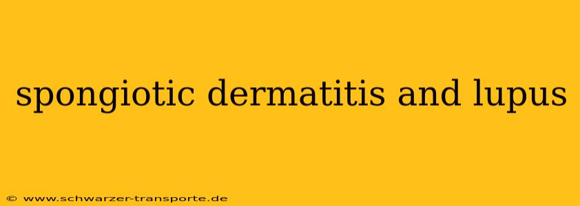 spongiotic dermatitis and lupus