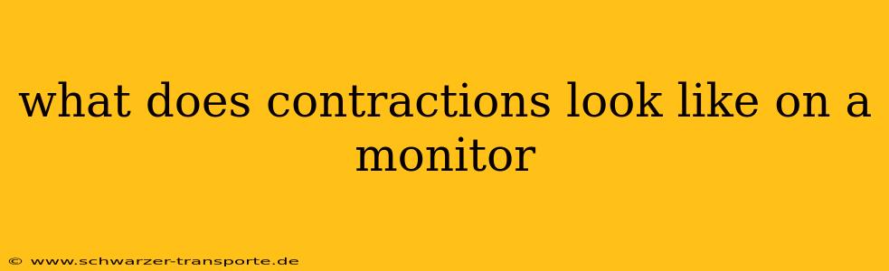 what does contractions look like on a monitor