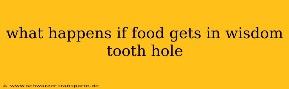 what happens if food gets in wisdom tooth hole