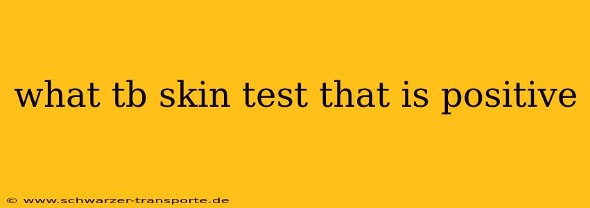 what tb skin test that is positive