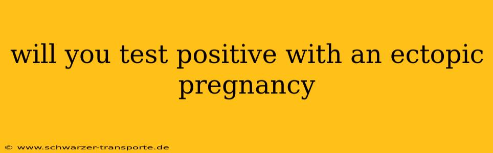 will you test positive with an ectopic pregnancy