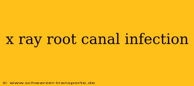 x ray root canal infection
